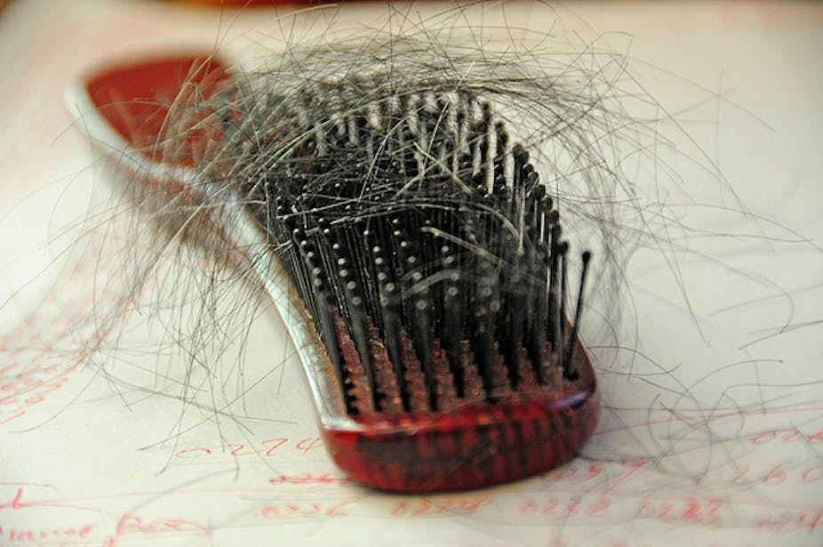 Health Check Why Does Women S Hair Thin Out