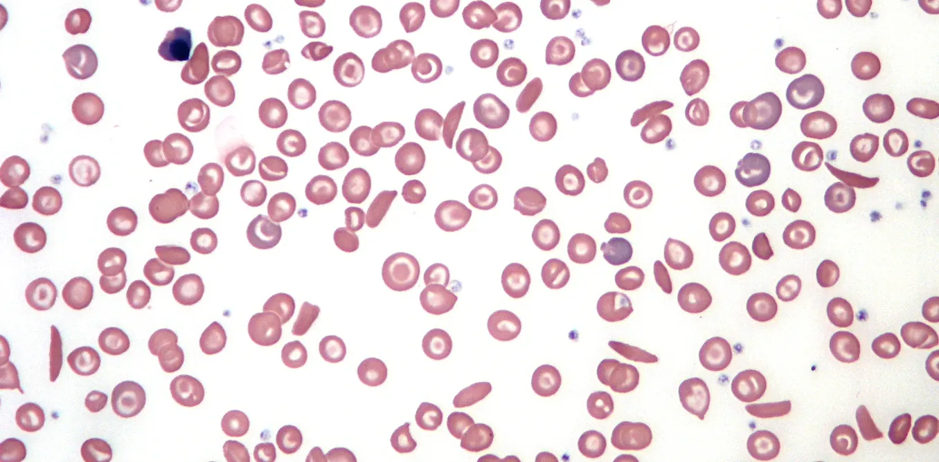 Mutant Blood Color Turning the tables: using genetic mutations to fix nature’s problems