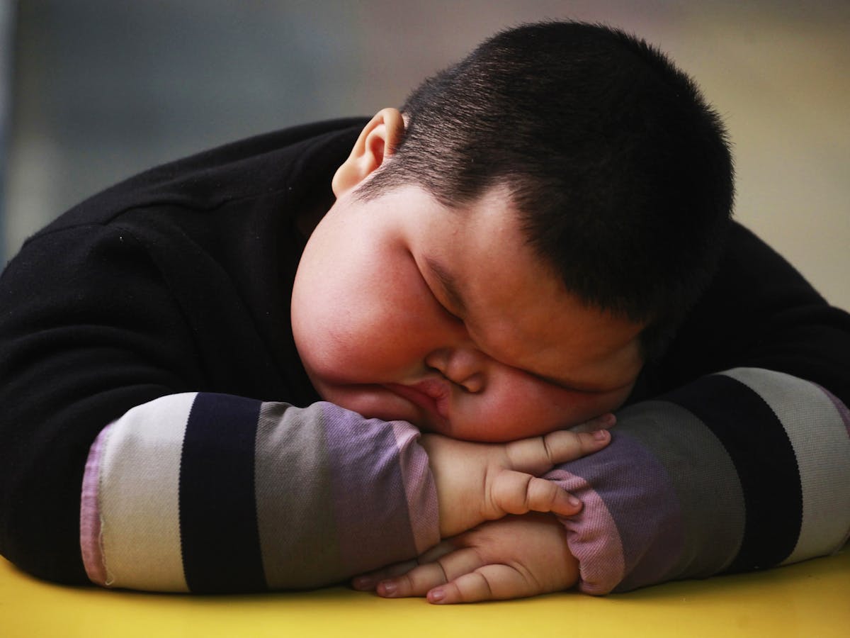 don t believe your child s baby fat will melt away with age