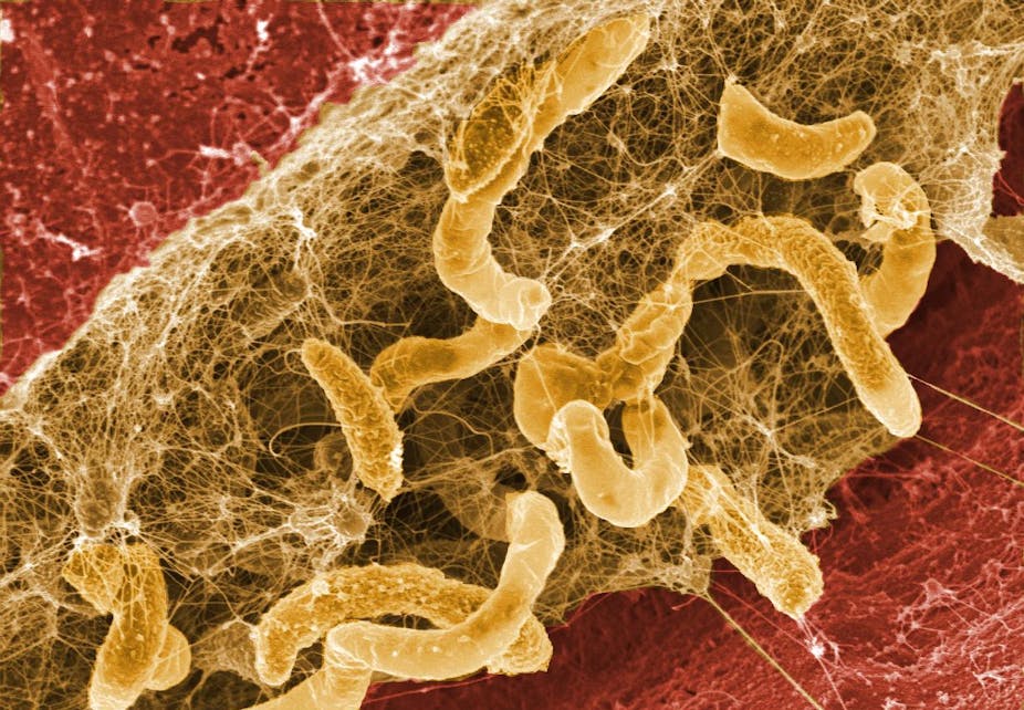 Biofilm Wound