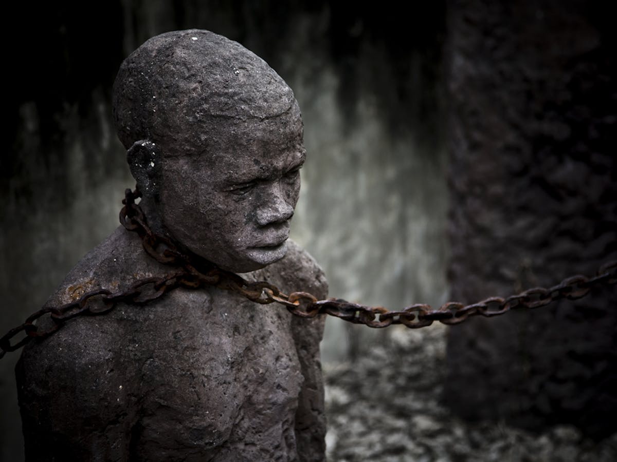 How Black Slaves Were Routinely Sold As Specimens To Ambitious White Doctors