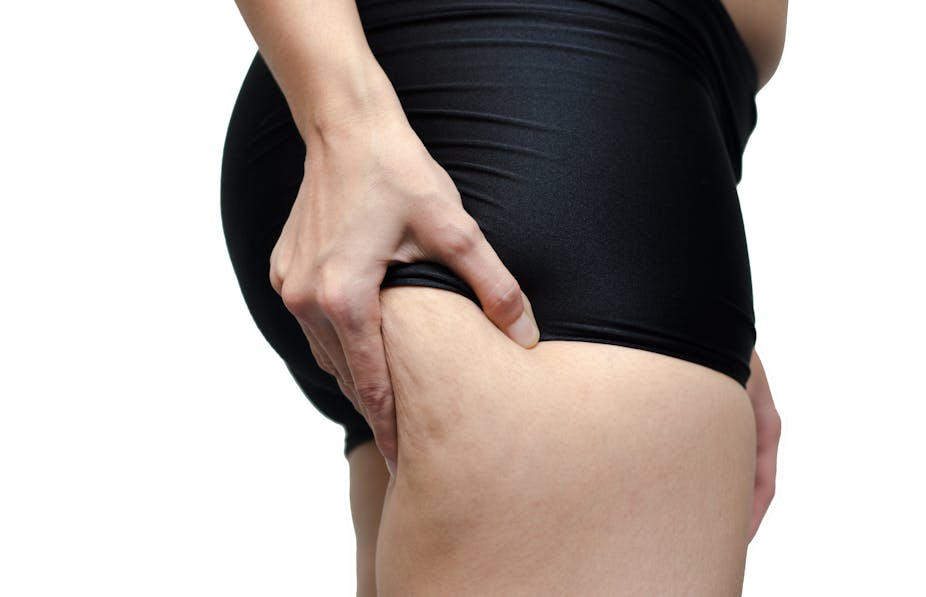 Health Check What Is Cellulite