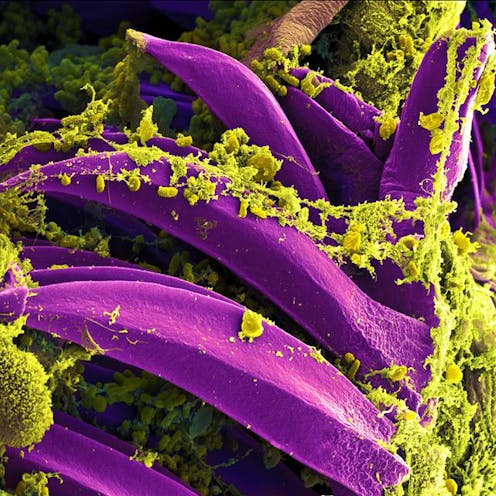 Yersinia pestis photo