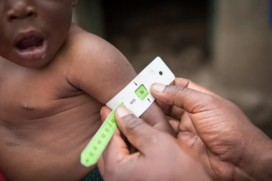 Stunted Development What Is Child Stunting – Childhood stunting: a global perspective – DDVLNE