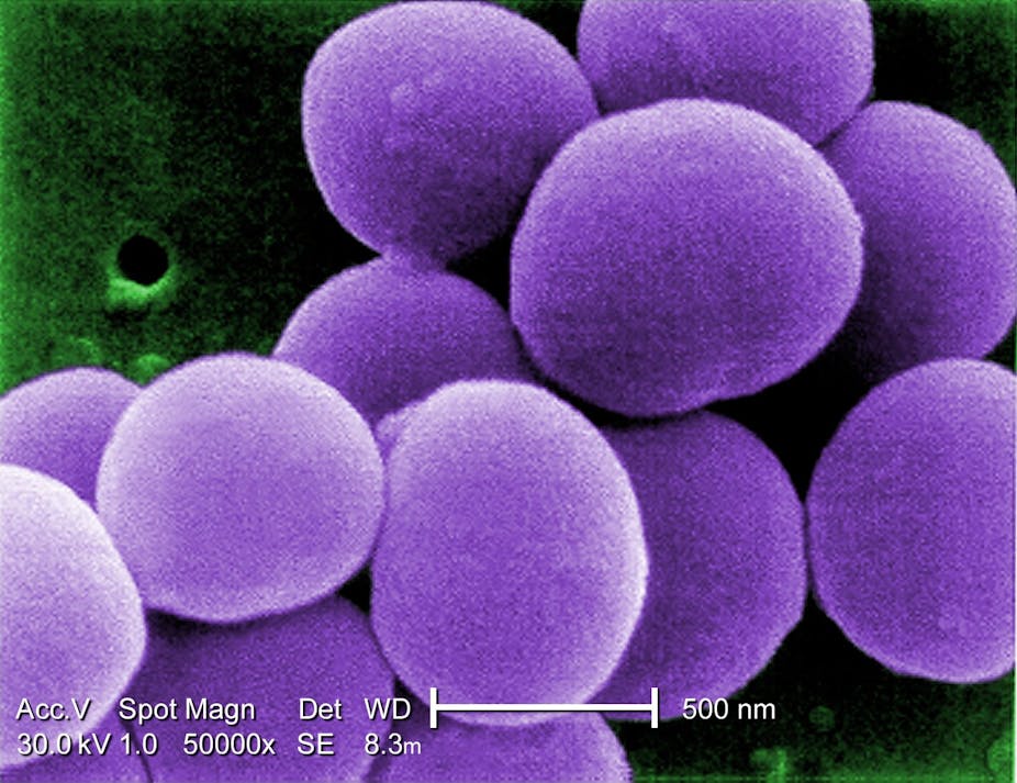 Distinguishing Deadly Staph Bacteria from Harmless Strains