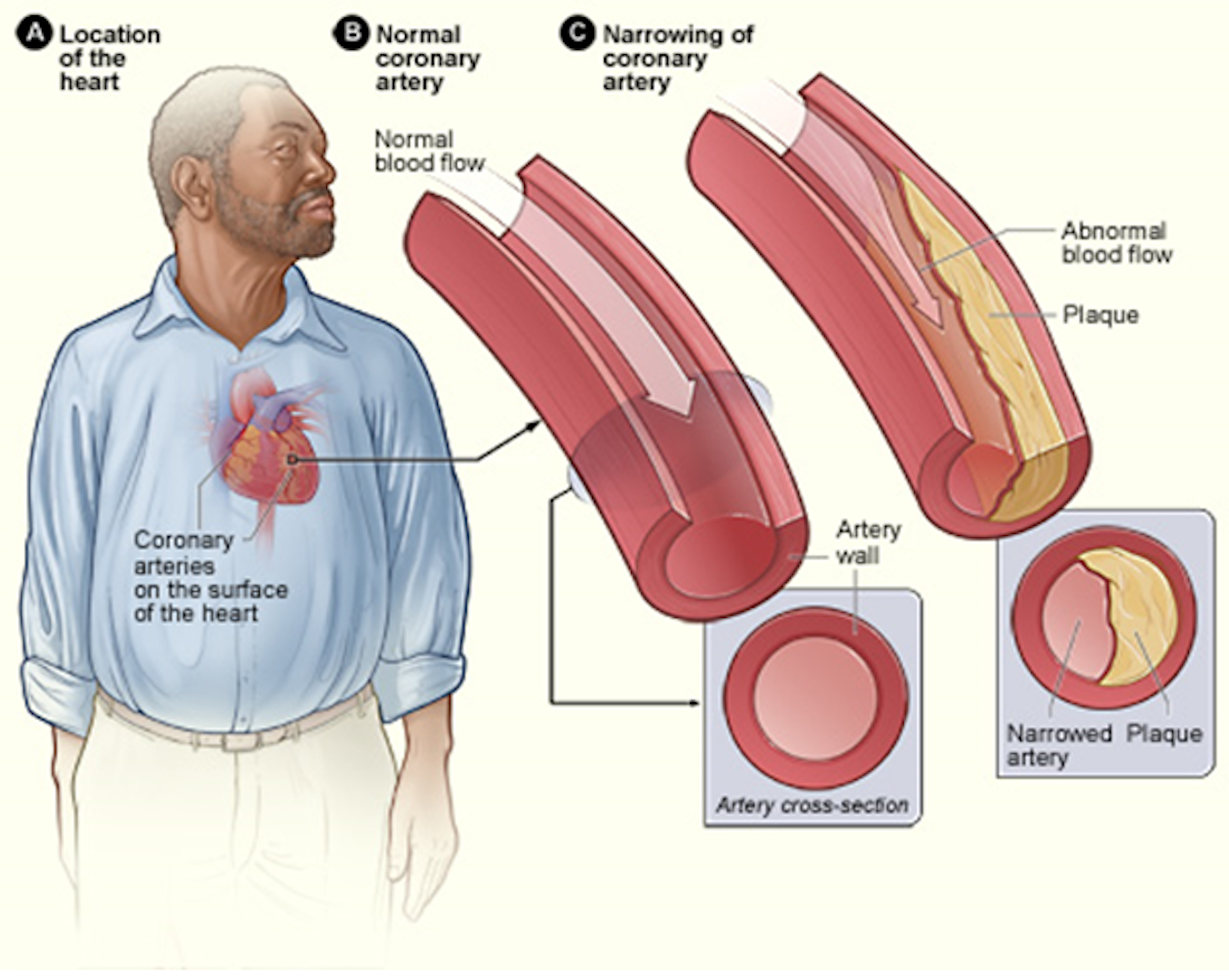 Stem cells could help mend a broken heart, but they