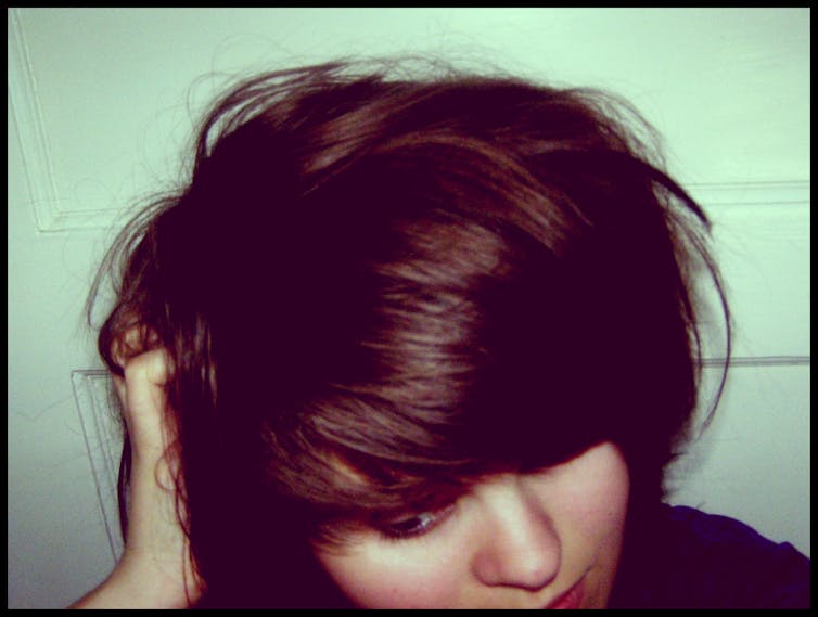 Pulling out your hair in frustration? What you need to know about trichotillomania Pulling out your hair in frustration? What you need to know about trichotillomania