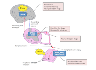 Why different painkillers are only effective for certain types of pain Why different painkillers are only effective for certain types of pain