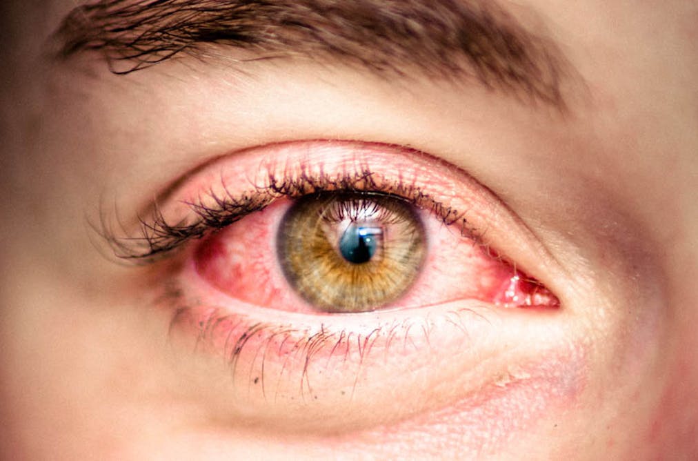 Health Check Whats The Right Way To Blow Your Nose